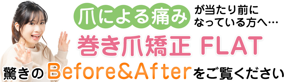 驚きのBefore&After